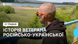 "Все, що пам'ятаю: повипльовував зуби й осліп" — історія ветерана російсько-української війни