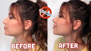 AT HOME RHINOPLASTY IN MINUTES! No surgery! No filler!