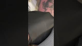 Touch our body (with the LightSense laser only)  Tattoo removal in action