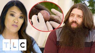 Dr. Lee Removes A QUADRUPLE Cyst On A Man's Head | Dr. Pimple Popper