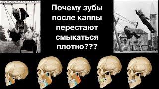 Почему пройдет боль в суставе и мышцах? При лечении на каппе МиР - Не чудо, а геометрия - ДВНЧС- НМР