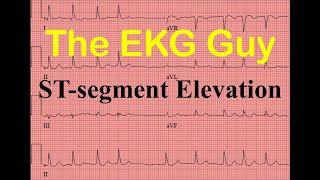 EKG/ECG ST-segment Elevation - Question 9.0 | The EKG Guy