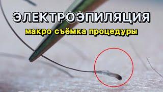 SO CLOSE YOU HAVE NOT SEEN | Electrolysis process | Electrolysis procedure