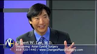 Asian Eyelid Surgery with San Diego Plastic Surgeon, Gilbert Lee  M D