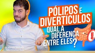 Pólipos e Divertículos - Qual a Diferença Entre Eles?