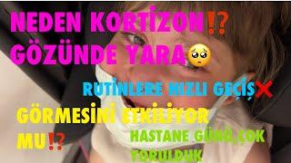 NEDEN KORTİZON,GÖZÜNDE YARAGÖRMESİNİ ETKİLİYOR MU⁉️RUTİNLERE HIZLI GEÇİŞ HASTANE GÜNÜ,ÇOK YORULDUK