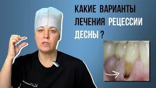 Какие варианты лечения рецессии десны