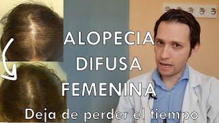 Alopecia difusa femenina: mejor tratamiento (dermatologo te lo explica)