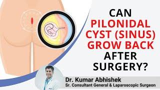 Can Pilonidal Cyst (Sinus) Grow Back after Surgery? | Recurrent पिलोनाइडल साइनस | Healing Hospital