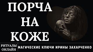 СРЕЖЬ ПОРЧУ С КОЖИ ЧЕРЕЗ НОЖНИЦЫ. КОЖНЫЕ БОЛЕЗНИ. РИТУАЛ ОНЛАЙН. РИТУАЛ ЧИСТКА. ИРИНА ЗАХАРЧЕНКО.