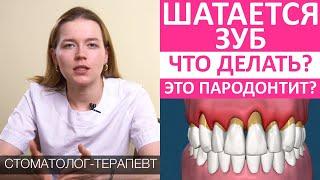 Шатается зуб. Что делать? Пародонтит: причины, последствия, лечение. Расшатывание, подвижность зубов