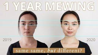 1 Year Mewing Before & After (Age 29)