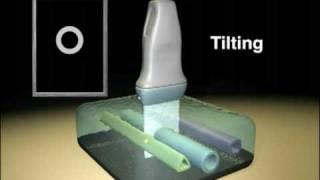 Ultrasound Transducer Manipulation