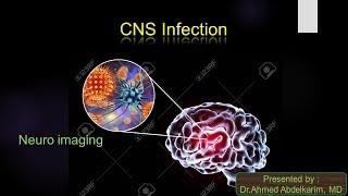 8-cerebral infection