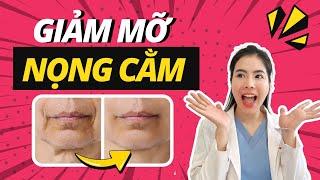 Cách Giảm Mỡ Mặt Nọng Cằm Giúp Thon Gọn Mặt | Dr Nhung