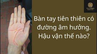 Đường âm hưởng trên bàn tay tiên thiên. Hậu vận thế nào? [Xem chỉ tay]