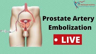 Live Prostatic Artery Embolization (PAE) Procedure Video for Enlarged Prostate Explained