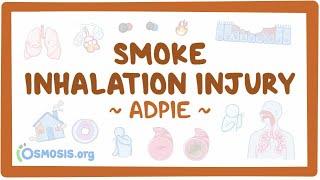 Smoke inhalation injury: Nursing Process (ADPIE)