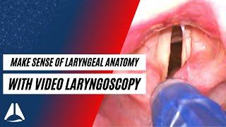 How to make sense of laryngeal anatomy with a video laryngoscope | ABCS of Anaesthesia Foundations