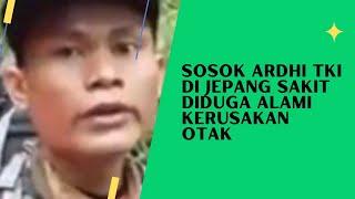 9 Kebiasaan yang Jadi Penyebab Kerusakan Otak Harus Diwaspadai #kebiasaan #penyebab #kerusakanotak