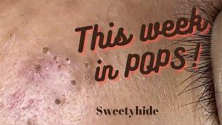 This Week In POPPING