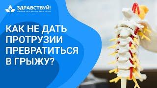 Как не дать протрузии превратиться в грыжу // Грыжа межпозвонковых дисков