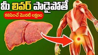 10 Symptoms of Liver Problem | Fatty Liver Symptoms | liver damage Sign | Dr. Kavya | iD Health 360