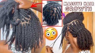 SHOCKING! You Will Never Have Short Hair Again. Moisturizing Mini Braids For 3X Hair Growth & Volume