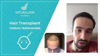 Best Hair Transplant Experience Day By Day Result