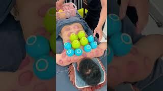 Chinese Cupping Therapy #asmr #cuppingtherapy #china #youtubeshorts