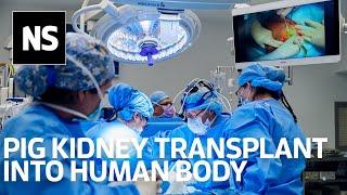 Could animal-to-human organ transplants become routine?