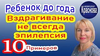 Вздрагивание не всегда эпилепсия 10 примеров. Ребенок до года. Невролог Краснова