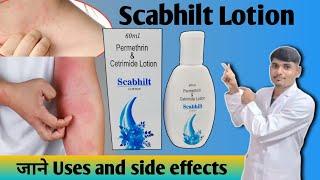 Permethrin 5% lotion ️ || scabies treatment || Head lice treatment #scabies​ #skinItching #khujli