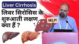 Liver Cirrhosis : लिवर सिरोसिस के शुरुआती लक्षण क्या हैं ? #liver #livercirrhosis #drzubindevshrma