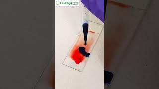 Platelet count of Blood #hereditybioacademy #reels