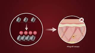 Chromatin De-Repression Determines Dermal Fibroblast Differentiation