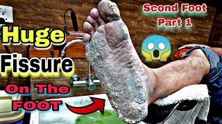 Smart Footcare pedicure & Manicure Funky skin Pedicure in Footcare33