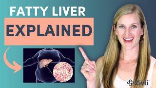 Fatty Liver Disease & Diet Explained