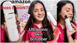 Tried ultrasonic skin scrubber for 1st time/ Removes blackheads? Review+ demo on acne prone skin