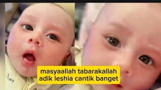 MATA ADIK LESHIA INDAH SEPERTI PAKAI SOFLEN MASYAALLAH INDAH BANGET