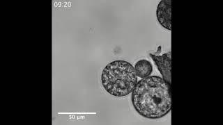 Unicellular relatives of animals: Sphaeroforma arctica - concatenated stacks