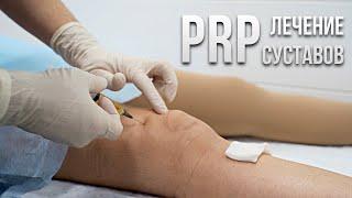 PRP против артроза. Лечение суставов в Васкул клиник
