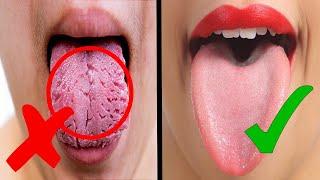 What Your Tongue Reveals About Your Health !!