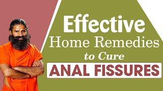 Effective Home Remedies To Cure Anal Fissures | Swami Ramdev