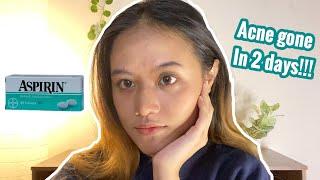 I tried to use ASPIRIN as acne spot treatment⎮English⎮74