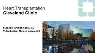 Heart Transplant Surgery | Anthony Zaki, MD (Graphic)