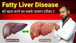 Fatty liver treatment by diet | Fatty liver diet plan | Signs And Symptoms Of Fatty Liver Disease