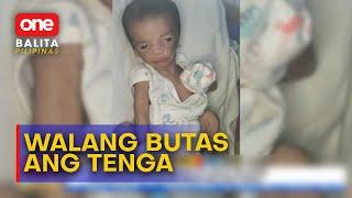 #OBP | 3-anyos sa Lanao del Norte, ipinanganak na walang butas ang tenga