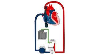 ECMO Circuit Without Oxygen