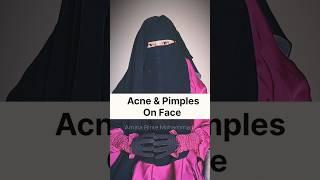 Acne & Pimples on face #acne #pimplessolution #wazifa #muslim #faceglowingtips #viral